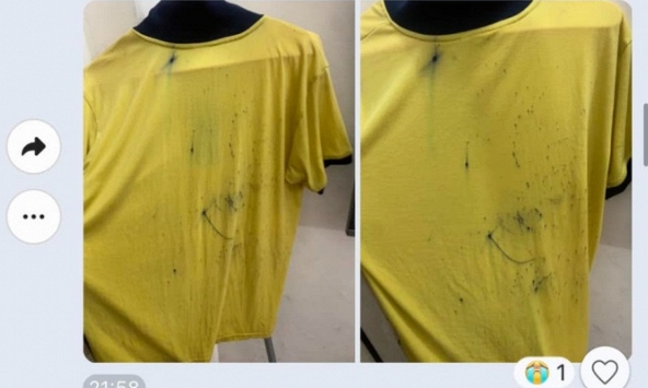 Bà mẹ chia sẻ hình ảnh chiếc áo con trai lấm tấm mực, phụ huynh khác hốt hoảng: 'Chuyển trường ngay, chị còn đợi điều gì nữa?'