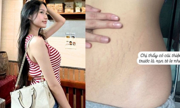 'Hot mom' Doãn Hải My không ngại khoe vết rạn cùng bụng 'màu mỡ' sau sinh 