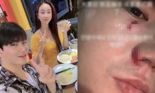 Bằng chứng Hoa hậu bạo hành chồng trẻ kém 18 tuổi