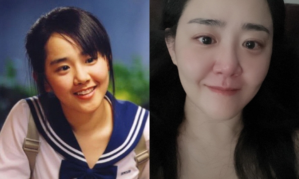 Bức ảnh gây lo lắng tột độ của 'Em gái quốc dân' Moon Geun Young