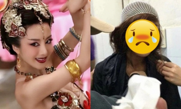 Mỹ nhân đẹp nhất màn ảnh bị chó nhà đồng nghiệp nổi điên cắn rách mặt giờ ra sao?