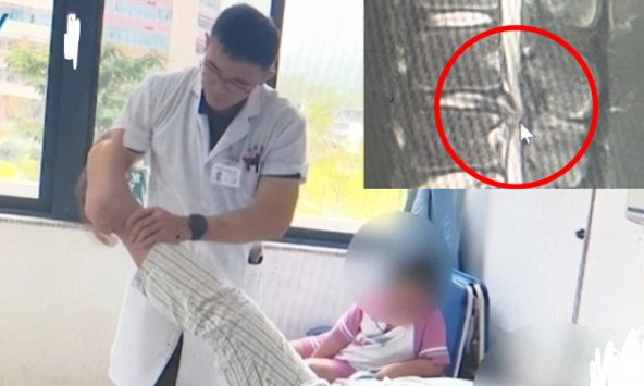 Nam sinh 16 tuổi suýt bị liệt suốt đời vì 1 sở thích khi dùng điện thoại hiếm người trẻ tuổi nào không có