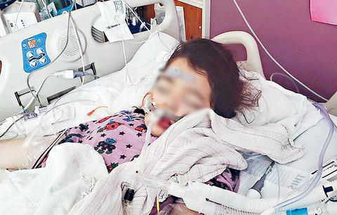 Phổi của bé gái 7 tuổi chuyển màu trắng xóa, suýt mất mạng vì 1 sai lầm khi chống nắng không hiếm người mắc