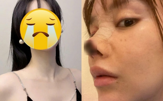 Ngỡ ngàng nhan sắc hiện tại của nữ diễn viên biến chứng 'dao kéo' kinh hoàng nhất showbiz một thời