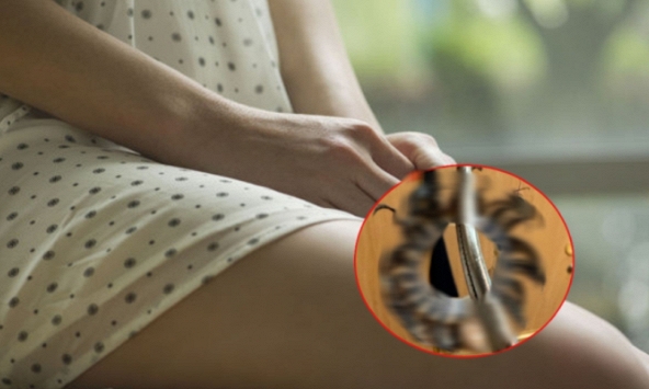Người phụ nữ sợ hãi khi bác sĩ lấy 1 vật ra khỏi vùng kín