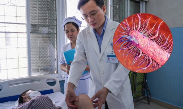 Người phụ nữ Thái Nguyên nguy kịch vì nhiễm vi khuẩn ăn thịt người, nguyên nhân bởi 1 sơ suất khi rửa rau