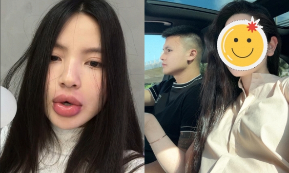 Không nhận ra vợ Quang Hải khi 'tái' thẩm mỹ gương mặt, tình trạng thế nào mà không dám gặp chồng con?