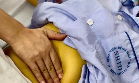 Người phụ nữ bị vàng mắt, vàng da tăng gấp 20 lần khi thường xuyên uống giảo cổ lam, cà gai leo