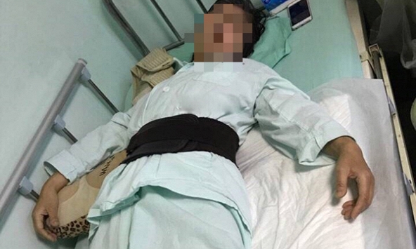 Xem X-quang xương của 'bà cụ 80 tuổi' bị gãy đốt sống, bác sĩ ngớ người khi biết bệnh nhân mới ngoài đôi mươi