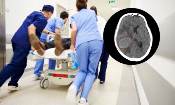 Phú Thọ: Người đàn ông yếu nửa người đi cấp cứu nghi đột quỵ, bàng hoàng nhận kết quả ung thư phổi giai đoạn cuối