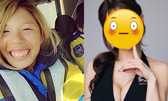 Sao nữ chi 4 tỷ thực hiện 27 cuộc thẩm mỹ, kết quả trùng tu gây sốc