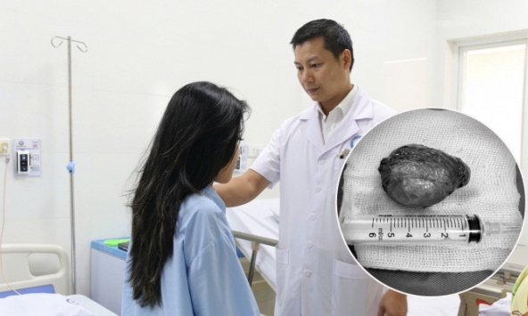 Nữ sinh 20 tuổi 'đeo' khối u khổng lồ trước cổ, chèn đường thở suốt 4 năm