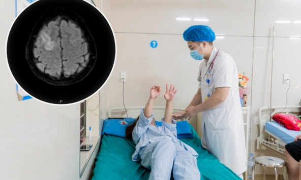 Đau đầu 5 ngày, người phụ nữ ở Phú Thọ bỗng ngã lăn ra đất, có giật, khó nói