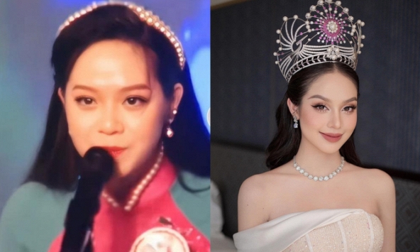 Ảnh phẫu thuật thẩm mỹ của hoa hậu Thanh Thuỷ gây sốt: Bác sĩ cảnh báo không phải ai cũng có thể làm