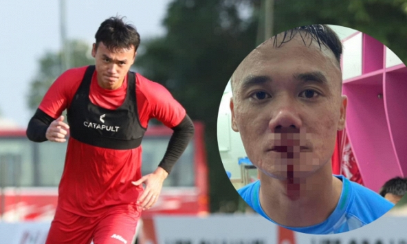 Tiền đạo ĐT Việt Nam bị đấm chảy máu mũi ở giải hạng Nhất, thực hư vụ việc thế nào?