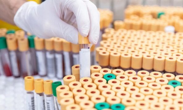 Australia thừa nhận làm mất 300 lọ mẫu virus gây chết người