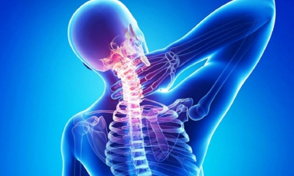 Bệnh thoái hóa đốt sống cổ mà siêu mẫu Minh Tú mắc phải nguy hiểm như thế nào?