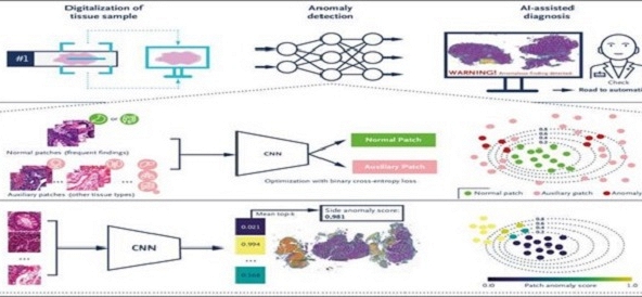 Mô hình AI phát hiện bất thường: Tiềm năng ứng dụng trong chẩn đoán các bệnh hiếm gặp