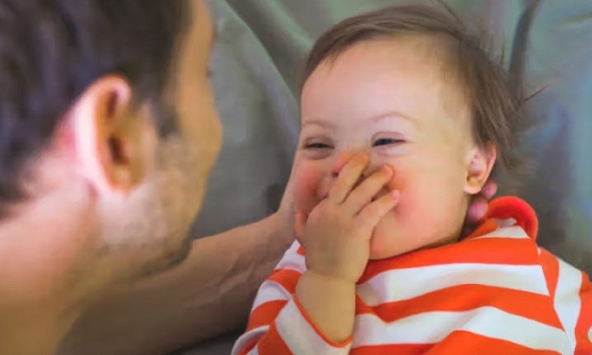 Liệu pháp tiềm năng đem hy vọng mới trong điều trị hội chứng Down