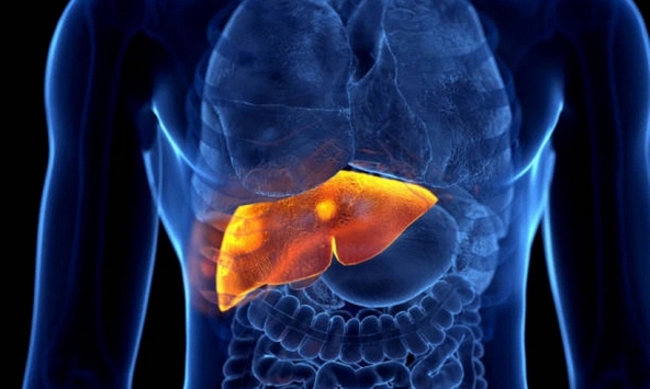 Công cụ AI giúp dự đoán nguy cơ tái phát ung thư gan