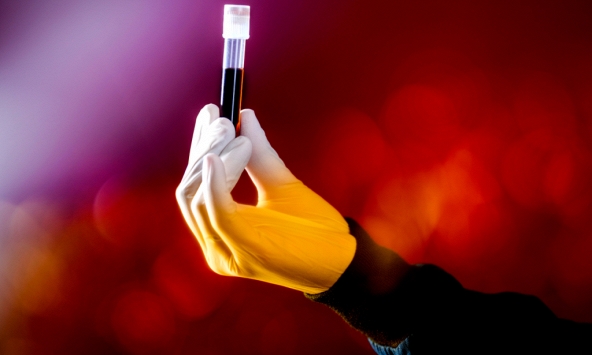 Xét nghiệm máu đột phá mở ra hy vọng mới trong sàng lọc ung thư