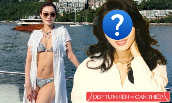 'Hoa hậu đẹp nhất' cũng phải nhờ đến 'dao kéo' để tìm sự hoàn hảo, thay đổi một vị trí nâng cao tầm nhan sắc 