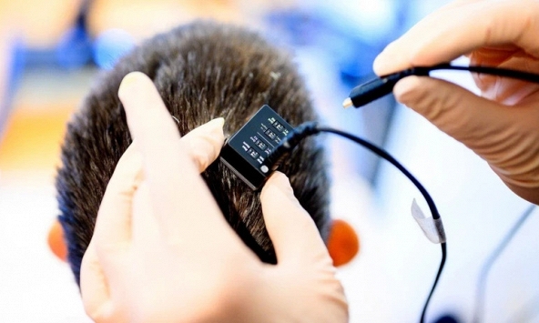 Thiết bị cấy ghép não giúp biến suy nghĩ thành giọng nói gần như tức thì