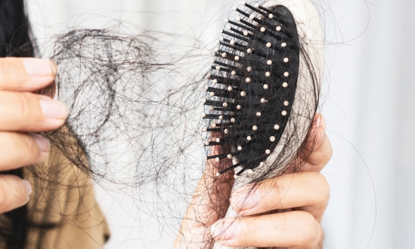 Giải pháp ngăn tóc rụng do rối loạn nội tiết