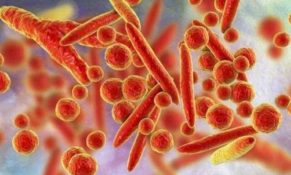 WHO bác thông tin về virus lạ gây triệu chứng ho ra máu ở Nga