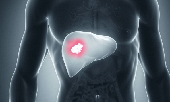 Các nhà khoa học phát hiện hợp chất tự nhiên ức chế sự phát triển ung thư gan