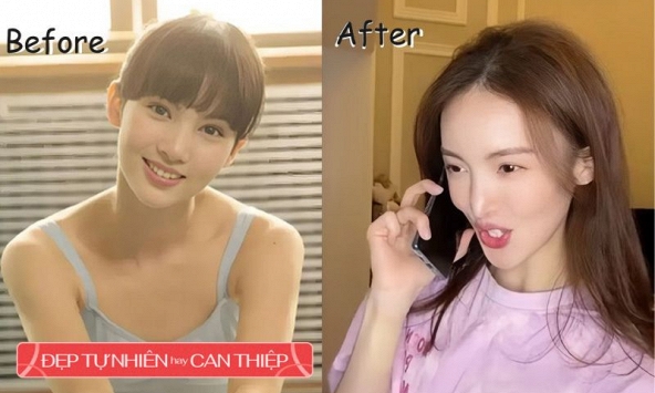 'Hoa khôi trường múa' từng được khen đẹp như tiên giáng trần nay nâng cấp thành 'mỹ nhân dao kéo'