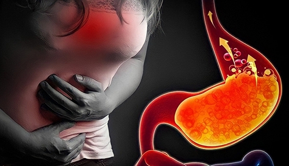 Nhận diện những thực phẩm “thủ phạm” gây trào ngược axit