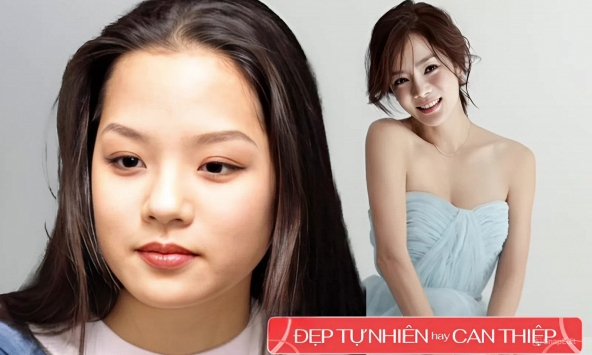 Nhan sắc 'dao kéo' trồi sụt của 'tình đầu quốc dân' sau nhiều năm giờ bất ngờ lại được khen nức nở