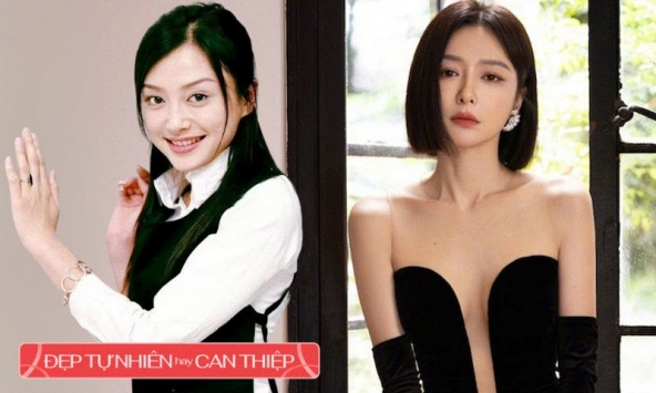 Mỹ nhân 'Diên Hi Công Lược' có nhan sắc “lão hoá ngược” thừa nhận “ai mà không thẩm mỹ”