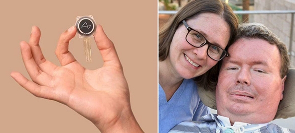 Chip Neuralink giúp người liệt toàn thân tạo video đăng Youtube bằng ý nghĩ