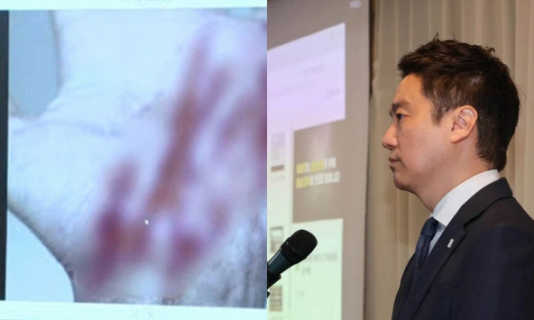 Như một trò đùa: Bằng chứng việc người nắm giữ ghi âm của Kim Sae Ron bị tấn công... thực chất là ảnh trên mạng