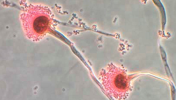 Cảnh báo nguy cơ phát tán loại nấm 'ăn thịt người' trong bối cảnh biến đổi khí hậu