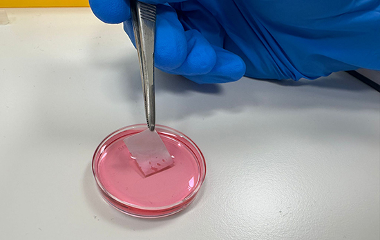 Israel phát triển da sinh học từ tế bào người giúp phục hồi vết bỏng nặng hiệu quả