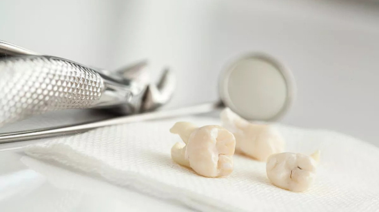 Răng khôn, “kho báu” tế bào gốc bị lãng quên