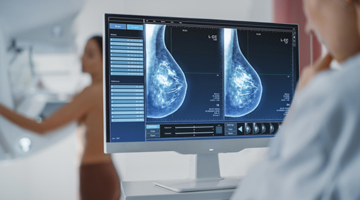 Các nhà khoa học Mỹ tìm ra cách ngăn ngừa ung thư vú tái phát