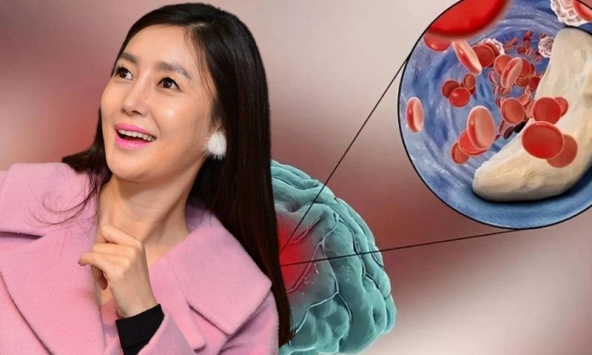 Nữ ca sĩ chia sẻ cơn ác mộng mang tên 'vỡ mạch máu não ở tuổi 34': Bắt đầu là những cơn đau đầu 'dữ dội như sét đánh'