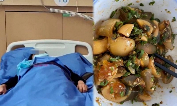 Một gia đình sáu người ăn trứng, 4 người bị ngộ độc và hai người nguy kịch phải chạy thận nhân tạo: Bác sĩ cảnh báo 'Đừng ăn kiểu này'