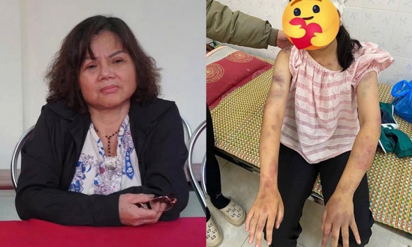 Vụ cháu bé bị bà nội và 2 người đàn ông bạo hành: Bà dương tính với ma túy, lý lịch bất hảo