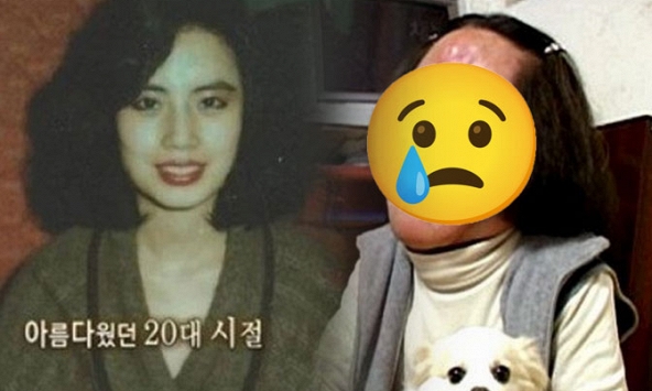 'Thảm họa thẩm mỹ' cuồng loạn tự tiêm dầu ăn vào mặt, từ mỹ nhân xinh đẹp cuối đời ra đi trong đau đớn 