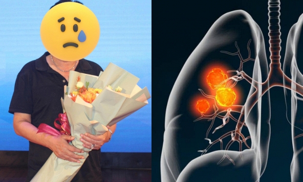 Một 'Táo Quân' bị ung thư phổi, tình trạng hiện tại khiến nhiều người xót xa