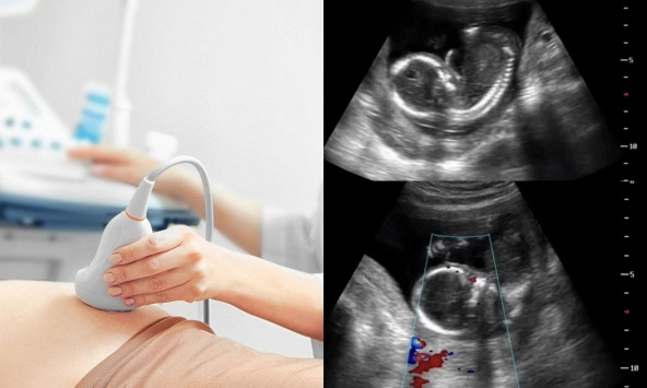 Thai phụ mất con sau khi bị buộc về quê làm cỗ: Câu chuyện khiến cộng đồng xót xa và cảnh báo nguy cơ cho mẹ bầu