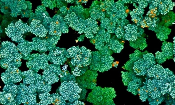 Singapore tìm ra giải pháp mới vô hiệu vi khuẩn kháng thuốc, đẩy nhanh quá trình lành vết thương mạn tính