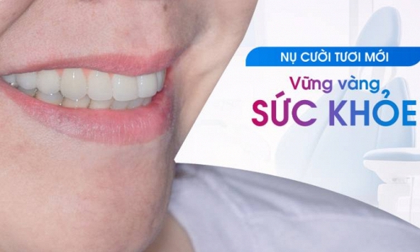 Trồng răng Implant an toàn và bền vững: Lựa chọn của nhiều bệnh nhân tại Nha Khoa Nhân Tâm