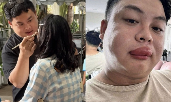 Cô dâu bị ong đốt, thợ make up đến “cứu” cũng bị đốt sưng môi: Người trong cuộc kể chuyện hy hữu