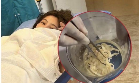 Một phụ nữ 32 tuổi thải ra sinh vật sống DÀI 3 MÉT, bác sĩ chỉ đích danh kiểu dùng thớt “gây hoạ” nhưng cực quen